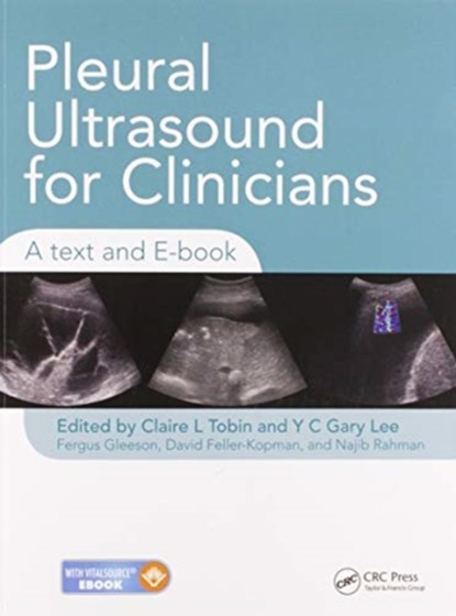 Pleural Ultrasound for Clinicians, Claire Tobin ; Y C Gary Lee ; Fergus Gleeson ; Najib Rahman ; David Feller-Kopman - Paperback - 9780367576158