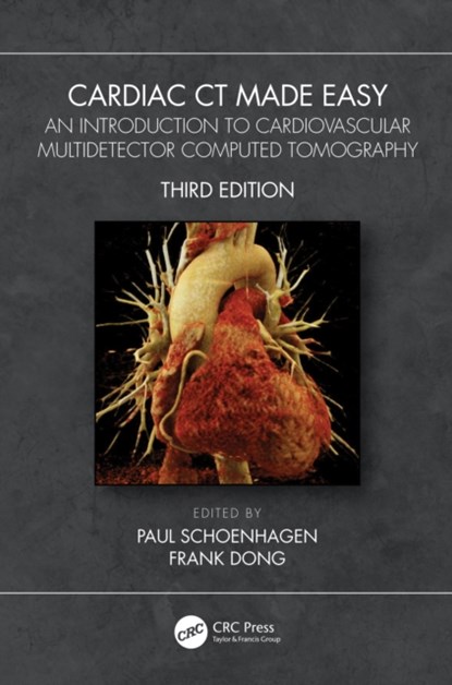 Cardiac CT Made Easy, PAUL (THE CLEVELAND CLINIC FOUNDATION,  Cleveland, Ohio, USA) Schoenhagen ; Frank (Cleveland Clinic, Cleveland, Ohio) Dong - Paperback - 9780367721473