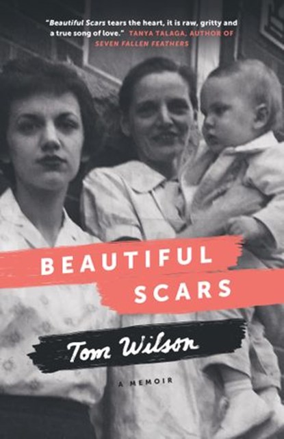 Beautiful Scars, Tom Wilson - Ebook - 9780385685665