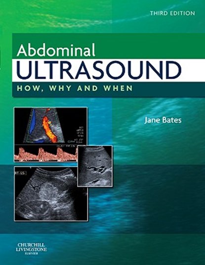 Abdominal Ultrasound, SMITH (FORMERLY BATES),  Jane A., MPhil DMU DCR (Cons Practitioner, Ultrasound, Leeds, UK) - Gebonden - 9780443069192