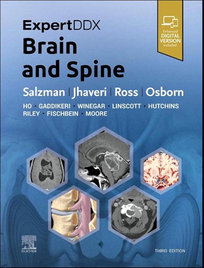 ExpertDDx: Brain and Spine, Karen L. (Professor of Radiology and Imaging Sciences Salzman ; Miral D. (Professor Jhaveri ; Jeffrey S. (Consultant Ross - Gebonden - 9780443106941