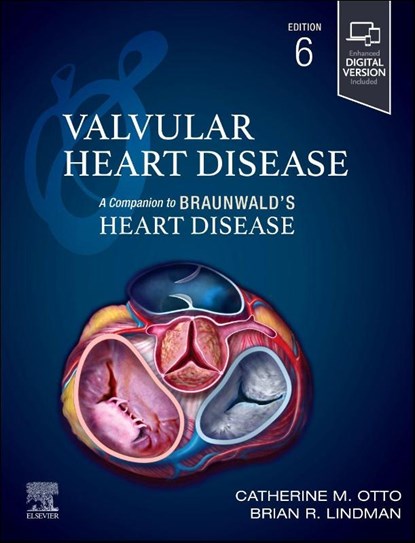 Valvular Heart Disease: A Companion to Braunwald's Heart Disease, Catherine M. Otto ; Brian R. Lindman - Gebonden - 9780443126888