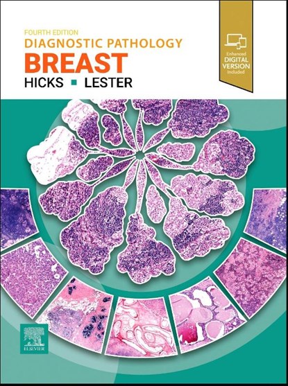 Diagnostic Pathology: Breast, Susan C. (Former Chief of Breast Pathology Services Lester ; David G. Hicks - Gebonden - 9780443286810