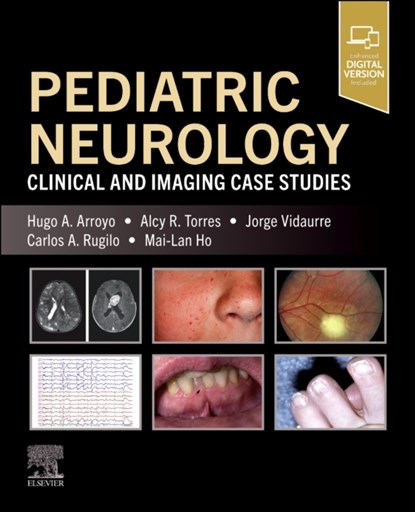 Pediatric Neurology, Hugo A. (Pediatric Neurology Arroyo ; Alcy R. (Director Pediatric Brain Injury Program Torres ; Jorge Vidaurre ; Carlos (Hospital de Pediatria J P Garrahan Rugilo - Paperback - 9780443287220