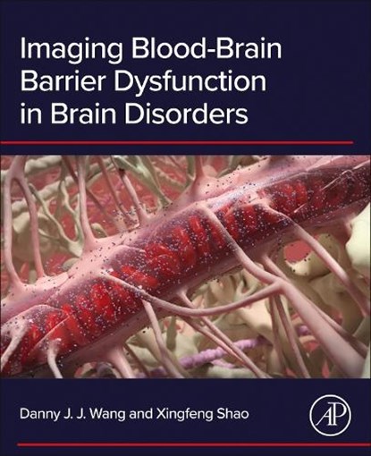 Imaging Blood-Brain Barrier Dysfunction in Brain Disorders, Danny J.J. Wang ; Xingfeng Shao - Paperback - 9780443329746