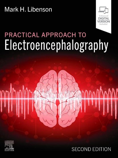 Practical Approach to Electroencephalography, Mark H Libenson - Gebonden - 9780443348365