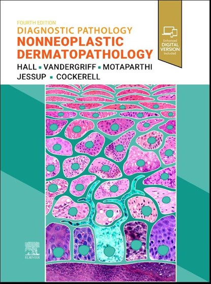 Diagnostic Pathology: Nonneoplastic Dermatopathology, Brian J. Hall - Gebonden - 9780443352591