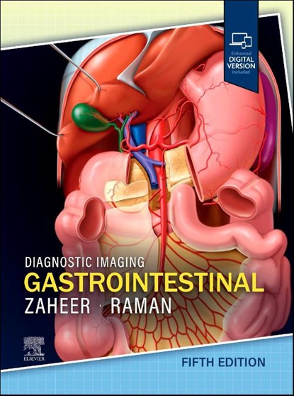 Diagnostic Imaging: Gastrointestinal, Atif (Professor of Radiology Zaheer ; Siva P. (Bay Imaging Consultants Raman - Gebonden - 9780443378782