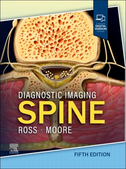 Diagnostic Imaging: Spine, Jeffrey S. (Consultant Ross ; Kevin R. (Pediatric Radiologist and Neuroradiologist Moore - Gebonden - 9780443378812