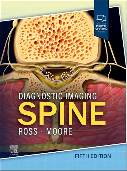 Diagnostic Imaging: Spine, Jeffrey S. (Consultant Ross ; Kevin R. (Pediatric Radiologist and Neuroradiologist Moore - Gebonden - 9780443378812