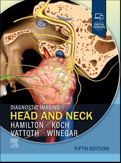 Diagnostic Imaging: Head and Neck, Bronwyn E. (Professor of Radiology Hamilton ; Bernadette L. (Associate Chief Koch ; Surjith Vattoth ; Blair A. Winegar - Gebonden - 9780443378904