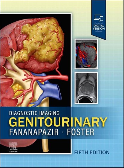 Diagnostic Imaging: Genitourinary, Ghaneh Fananapazir ; Bryan R Foster - Gebonden - 9780443380365