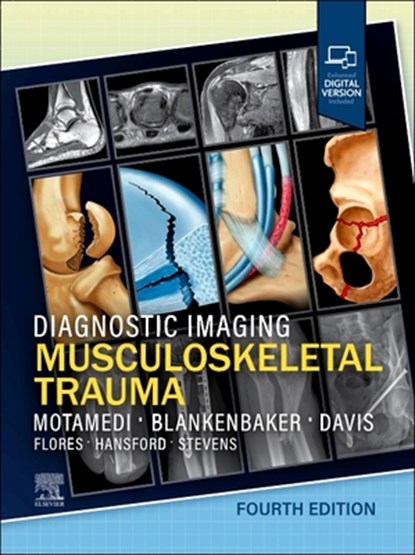 Diagnostic Imaging: Musculoskeletal Trauma, Kambiz Motamedi ; Donna G. Blankenbaker ; Kirkland W. Davis - Gebonden - 9780443433429