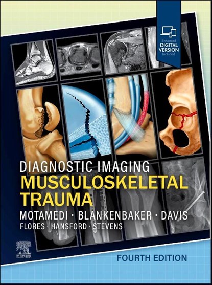 Diagnostic Imaging: Musculoskeletal Trauma, Kambiz Motamedi ; Donna G. Blankenbaker ; Kirkland W. Davis - Gebonden - 9780443433429