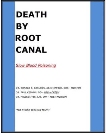 Death By Root Canal, Dr. Ronald S. Carlson ; Dr. Paul Kenyon ; Dr. Melissa Yee - Ebook - 9780463585023