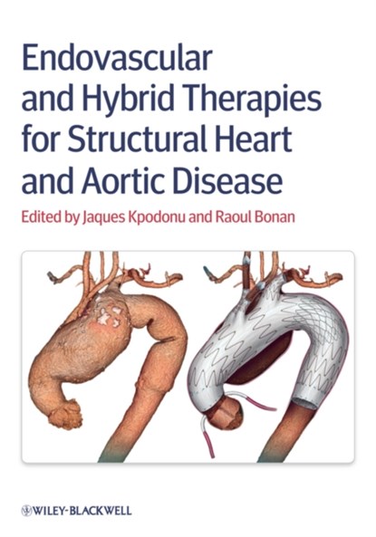 Endovascular and Hybrid Therapies for Structural Heart and Aortic Disease, Jacques (Northwestern Memorial Hospital) Kpodonu ; Raoul Bonan - Gebonden - 9780470656396