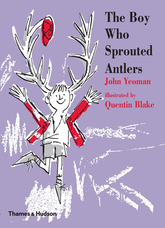 Boy who sprouted antlers