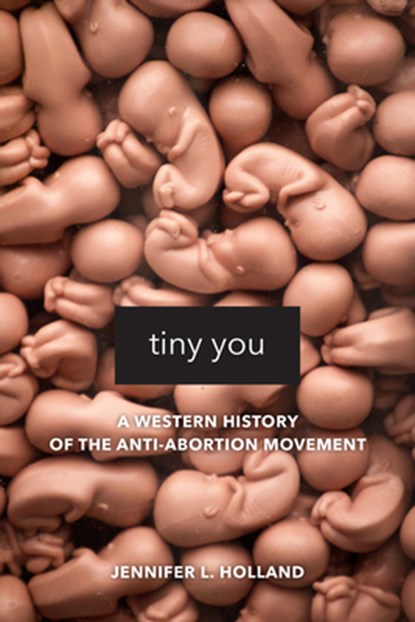 Tiny You, Jennifer L. Holland - Paperback - 9780520295872