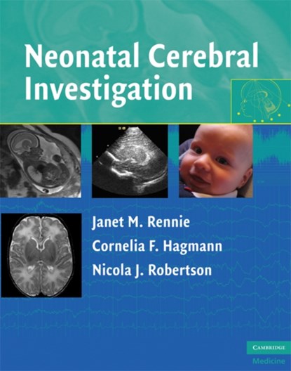 Neonatal Cerebral Investigation, JANET M. (DR,  University College London) Rennie ; Cornelia F. (Dr, University College London) Hagmann ; Nicola J. (Dr, University College London) Robertson - Gebonden - 9780521838481