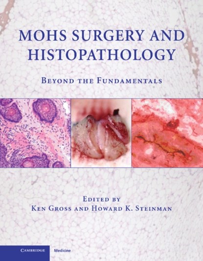 Mohs Surgery and Histopathology, KEN,  MD (University of California, San Diego) Gross ; Howard K. (Texas A & M University) Steinman - Gebonden - 9780521888042