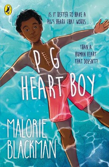 Pig-Heart Boy, Malorie Blackman - Paperback - 9780552551663