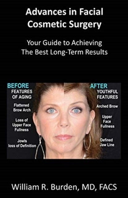 Advances in Facial Cosmetic Surgery, William R Burden - Paperback - 9780578715599