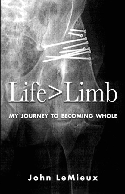 Life is Greater Than Limb, John LeMieux - Paperback - 9780578876887