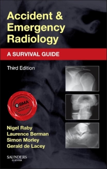Accident and Emergency Radiology: A Survival Guide, Nigel (Consultant Radiologist Raby ; Laurence (Lecturer and Honorary Consultant Radiologist Berman ; Simon (Consultant Radiologist Morley ; Gerald de Lacey - Paperback - 9780702042324