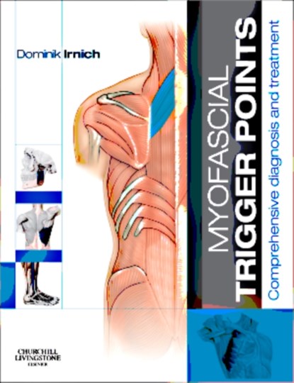 Myofascial Trigger Points, DOMINIK (HEAD OF THE MULTIDISCIPLINARY PAIN CENTRE,  Department of Anesthesiology, University of Munich, Germany) Irnich - Paperback - 9780702043123