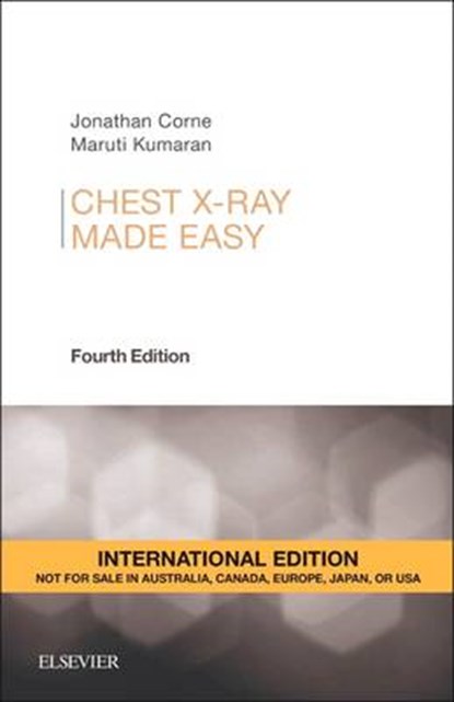 Chest X-Ray Made Easy, Jonathan Corne ; Maruti Kumaran - Paperback - 9780702055003