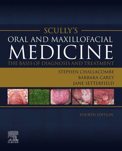 Scully's Oral and Maxillofacial Medicine: The Basis of Diagnosis and Treatment, Stephen J. (Martin Rushton Professor of Oral Medicine Challacombe ; Barbara Carey ; Jane Setterfield - Paperback - 9780702080111