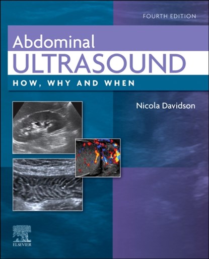 Abdominal Ultrasound, Nicola Davidson - Gebonden - 9780702082436