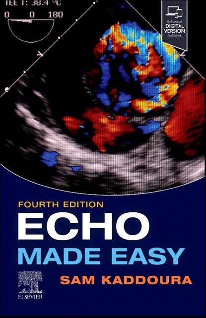 Echo Made Easy, Sam Kaddoura - Paperback - 9780702083600