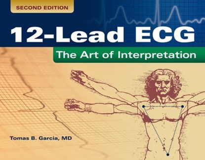 12-Lead ECG: The Art Of Interpretation, Tomas B. Garcia - Paperback - 9780763773519