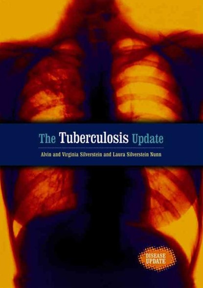 The Tuberculosis Update, SILVERSTEIN,  Alvin - Gebonden - 9780766024816