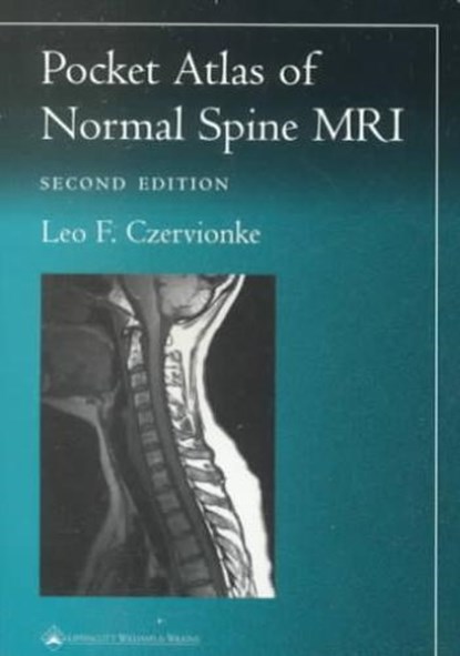 Pocket Atlas of Spinal MRI, CZERVIONKE,  Leo F. - Paperback - 9780781729482