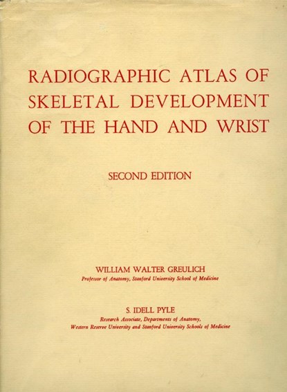 Radiographic Atlas of Skeletal Development of the Hand and Wrist, William Walter Greulich ; S. Idell Pyle - Gebonden - 9780804703987