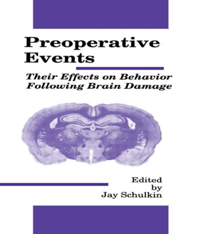 Preoperative Events, Jay Schulkin - Gebonden - 9780805800210