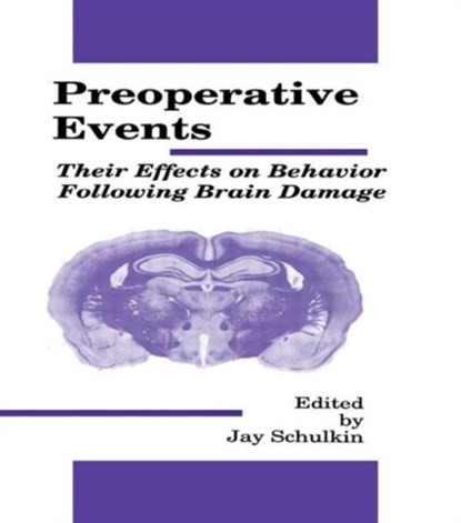 Preoperative Events, Jay Schulkin - Paperback - 9780805805352