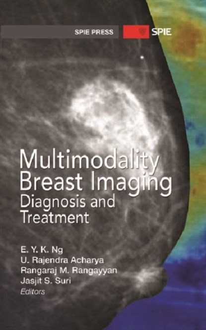 Multimodality Breast Imaging, E. Y. K. Ng - Gebonden - 9780819492944