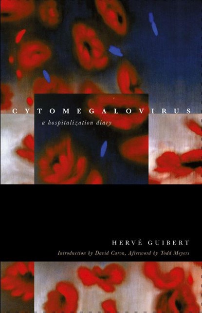 Cytomegalovirus, Herve Guibert - Paperback - 9780823268573