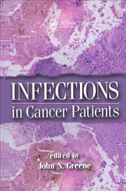 Infections in Cancer Patients, John N. Greene - Gebonden - 9780824754372