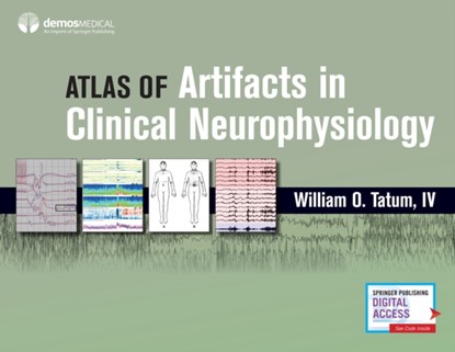 Artifacts in Clinical Neurophysiology, WILLIAM O.,  IV Tatum - Gebonden - 9780826169341