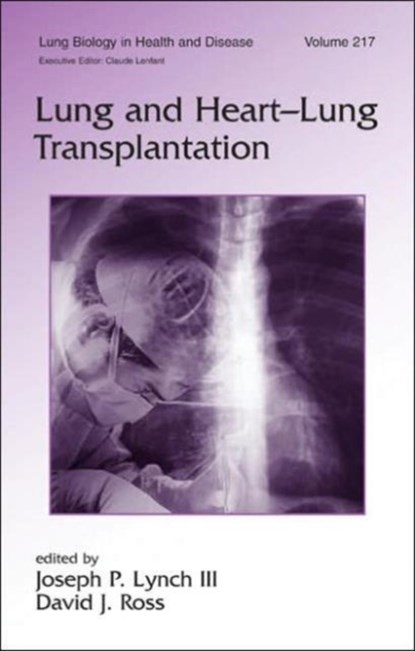 Lung and Heart-Lung Transplantation, JOSEPH P. (UCLA,  Los Angeles, California, USA) Lynch ; David J. Ross - Gebonden - 9780849337178