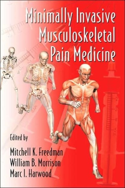 Minimally Invasive Musculoskeletal Pain Medicine, Mitchell (Jefferson Medical College Freedman ; William B. (Thomas Jefferson University Hospital) Morrison MD ; Marc I. (Thomas Jefferson University) Harwood - Gebonden - 9780849372568