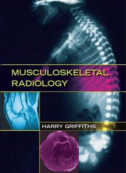 Musculoskeletal Radiology, HARRY (UNIVERSITY OF FLORIDA,  Jacksonville, FL, USA) Griffiths - Gebonden - 9780849393907