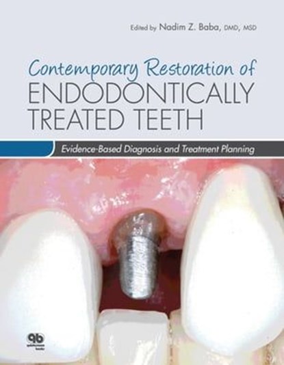 Contemporary Restoration of Endodontically Treated Teeth, Nadim Z. Baba - Ebook - 9780867156003