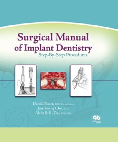 Surgical Manual of Implant Dentistry, Daniel Buser ; Jun-Young Cho ; Alvin B. Yeo - Ebook - 9780867157062