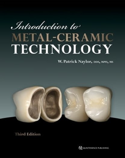 Introduction to Metal-Ceramic Technology, W. Patrick Naylor - Ebook - 9780867157536