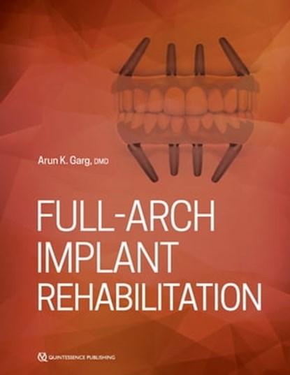 Full-Arch Implant Rehabilitation, Arun Garg - Ebook - 9780867158106